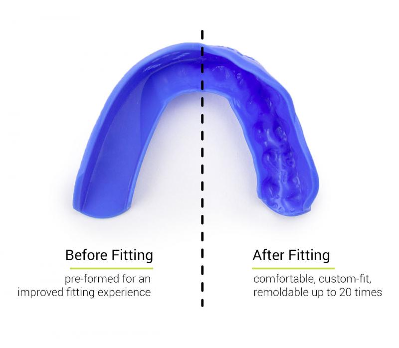 Will This Mouthguard Revolutionize Your Game. How the Sisu Aero Guard is Transforming Athletic Performance